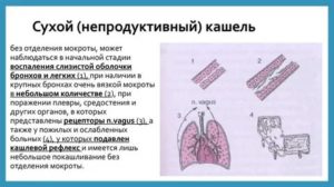 Непродуктивный кашель