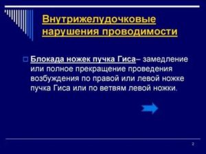 Нарушение вн. Желудочковой проводимости у подростка. Жалоб нет