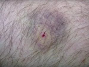 Поцарапал кот возможно бешенство?