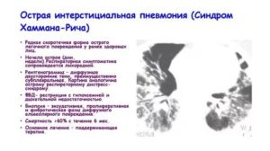 Консультация по неспецифическая интерстициальная пневмония