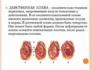 После лишения девственности больно писать