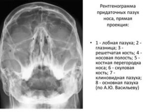 Расшифровка снимка носа