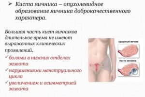 Пулъсация в области яичников