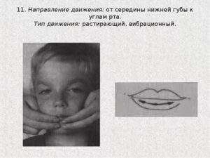 Дергается губа