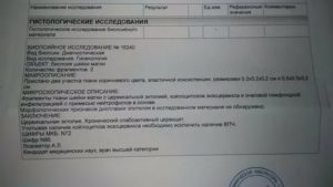 Помогите расшифровать биопсию