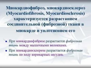 Миокардиофиброз