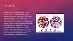 Похоже ли на лейкоз