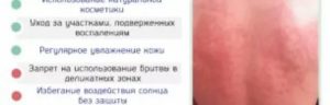Красное пятнышко, без зуда и болей