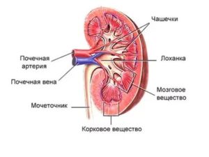 Признаки расщепления почечного синуса справа