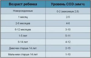 Соэ у ребенка, hla-b27. для чего этот анализ?