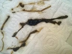 Коричневые сгустки во время месячных
