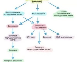 Эрозия Шейки матки (дисплазия 3 ст)