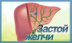 Застой желчи