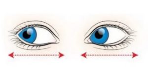 Боль при движении глаз вправо и влево