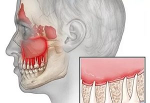 Боль справа сверху в области двух последних зубов