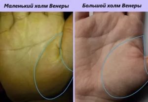 Зуд холма Венеры, покраснел, опух