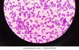 Степень критичности микроорганизмов: 1-Neisseria subflava 10^5, 2-Candida albicans 10^3