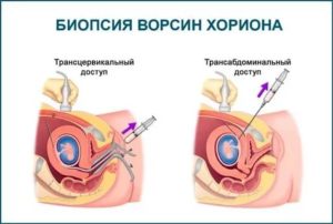 Исследование хориона