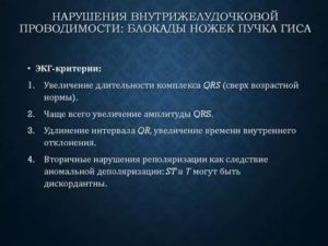 Нарушение вн. Желудочковой проводимости у подростка. Жалоб нет