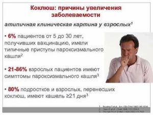Коклюш у взрослых