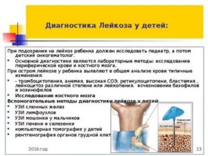 Подозрение на лейкоз?