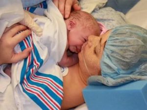 Кесарево 30 недель беременности