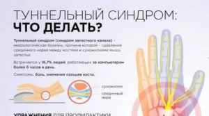 Не работает левая рука