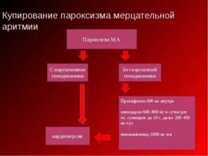 Купирование приступа мерцательной аритмии