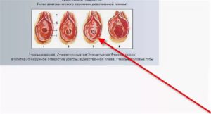 После лишения девственности больно писать