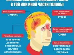 Чувство сдавленности в голове в сидячем положении