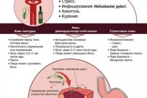 Хеликобактер, боль после лечения