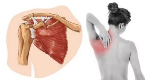 Боль при глотании отдается в ключицу и лопатку