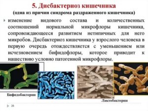 Дисбактериоз ли это?, или синдром раздраженного кишечника