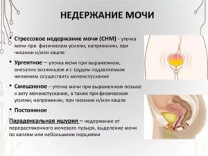 Частые мочеиспускания после родов