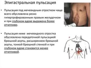 Пульс в районе пупка и выше