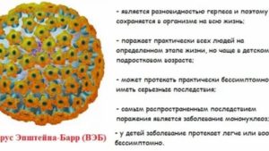 Вирус Эйнштейн барра и герпеса в слюне