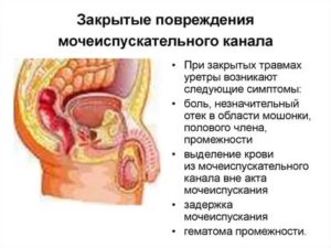 Кровь из уретры после полового акта