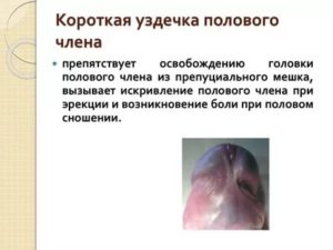 Два отверстия в головке полового органа, нормально ли это?