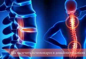 Лечение хондроза при наличии онкологии