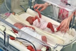 Кесарево 30 недель беременности