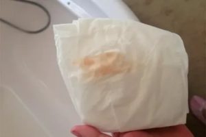 Кровянистые выделения при задержке