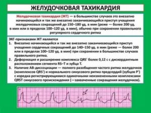 Приступы тахикардии при простуде