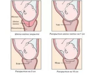 Как проверить шейку матки