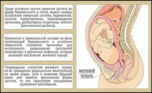 Что означает половой покой во время беременности