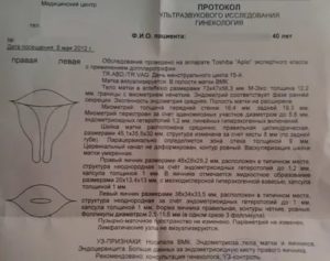 Какие я должна сдать анализы при кисте левого яичника