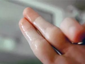 Клайра и обильные выделения