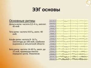 Расшифровка ЭЭГ для ребенка