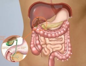 Застой желчи