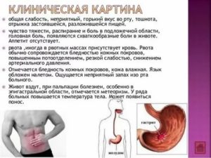 Болит желудок, подташнивает, бросает в жар