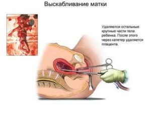 Через какое время после операции можно заниматься сексом и спортом